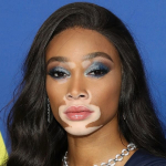 Winnie Harlow