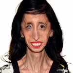 Lizzie Velasquez