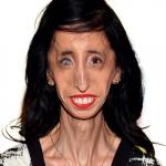Lizzie Velasquez