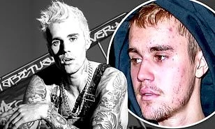 Justin Bieber confirma que padece la enfermedad de Lyme 