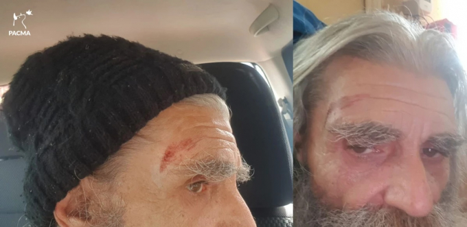 El actor Peter Macgiver es agredido por un grupo de cazadores