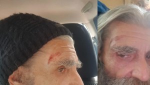El actor Peter Macgiver es agredido por un grupo de cazadores