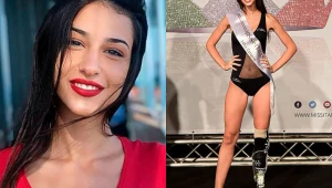 La lección a sus haters de Chiara Bordi, la primera Miss italiana con una pierna biónica