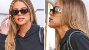 Khloé Kardashian se extirpó un tumor de la cara: 