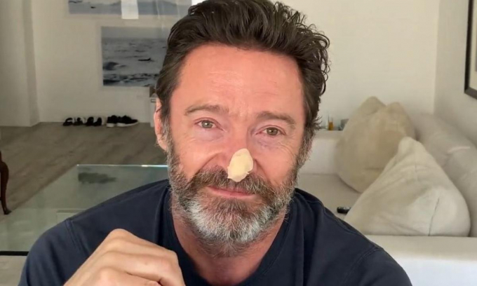 Hugh Jackman revela los resultados de su biopsia ante el riesgo de cáncer de piel