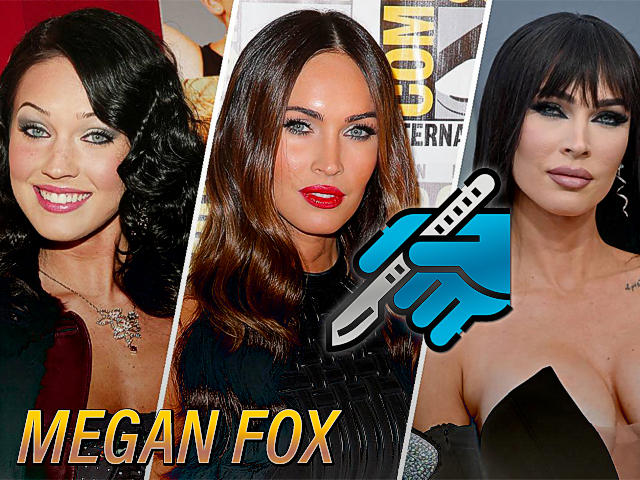 Megan Fox confiesa todas sus cirugías plásticas