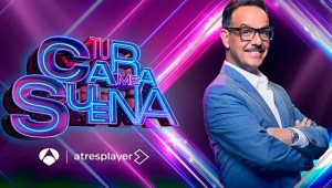 Ángel Llàcer sorprende con un brazo roto en 'Tu cara me suena': Este es el motivo