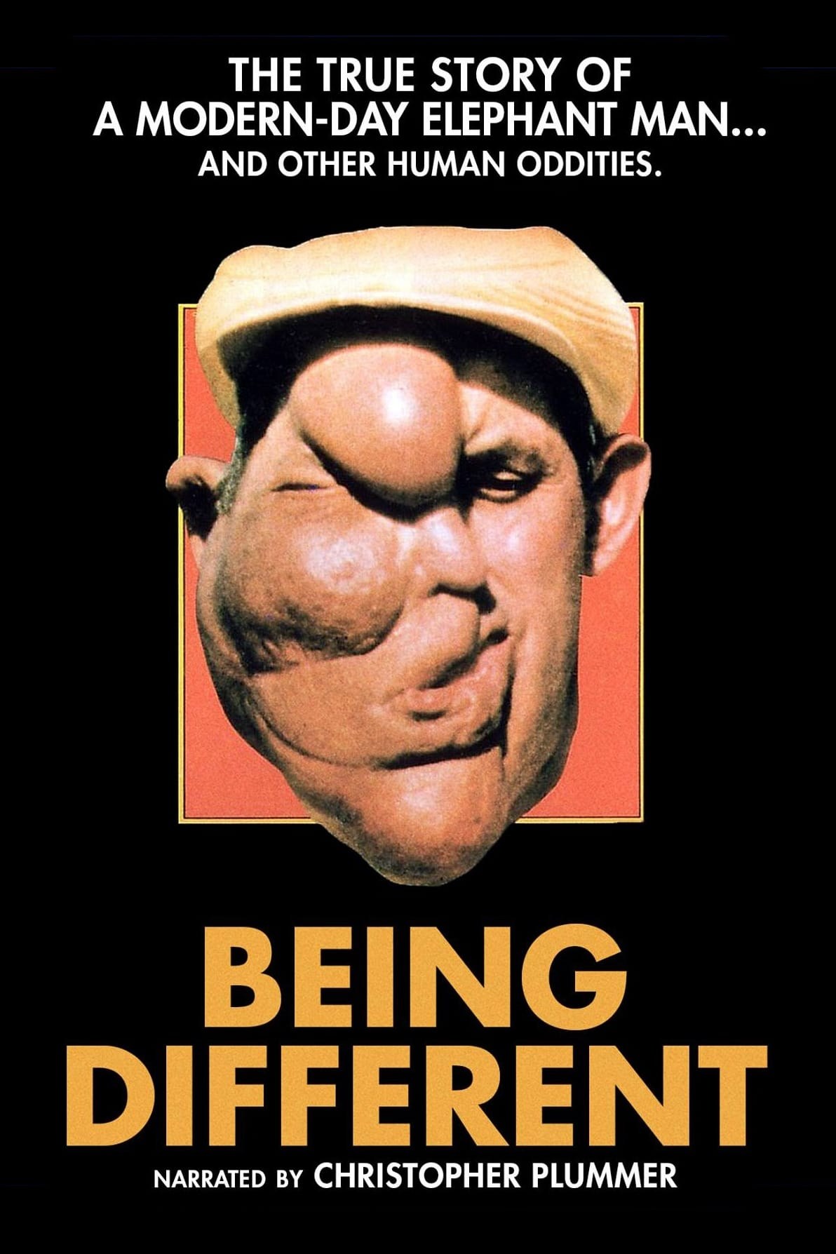 Poster de BEING DIFFERENT