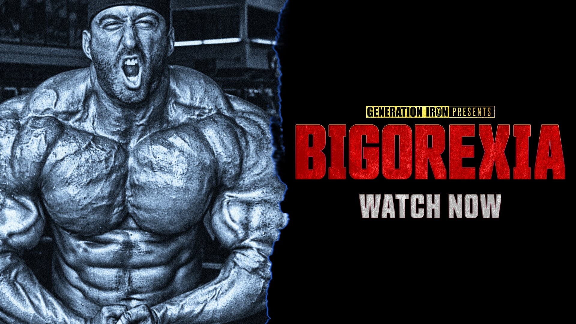 Foto de BIGOREXIA