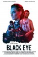 Black Eye