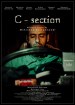 C-section