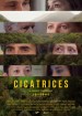Cicatrices