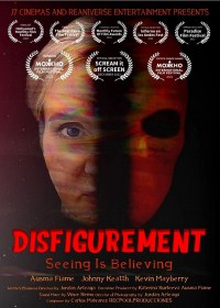 Disfigurement