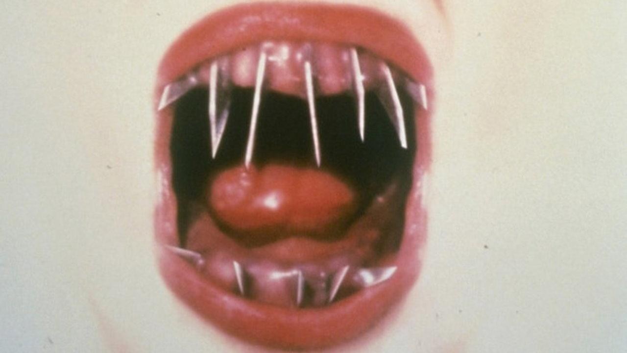 Foto de EL DENTISTA 2