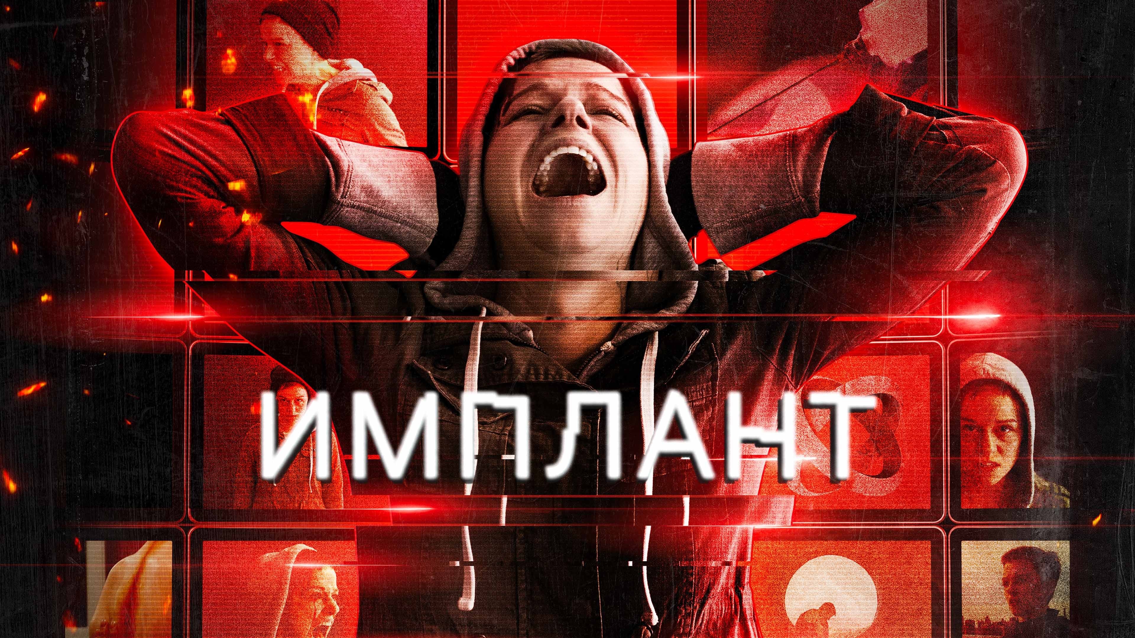 Foto de IMPLANTED