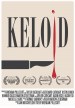 Keloid