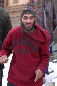 Mattu (Microcephaly in Pakistan)