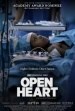 Open Heart