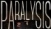 Paralysis