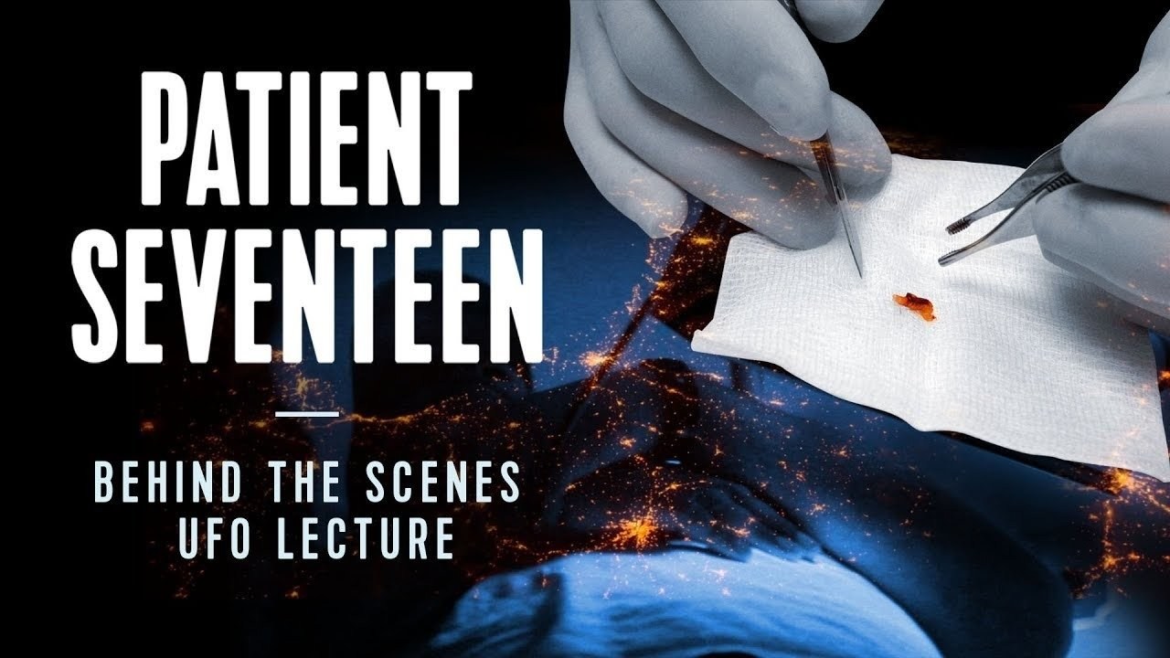 Foto de PATIENT SEVENTEEN