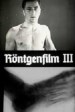 Röntgenstrahlen