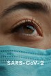 Sars-Cov-2