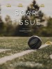 Scar Tissue