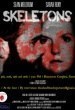 Skeletons