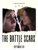 The Battle Scars 2