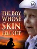The Boy Whose Skin Fell Off