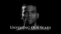 Unveiling our Scars