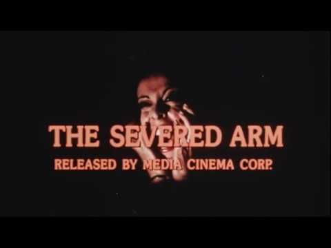 The Severed Arm