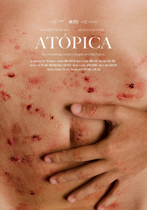 Atopica