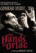 The Hands of Orlac