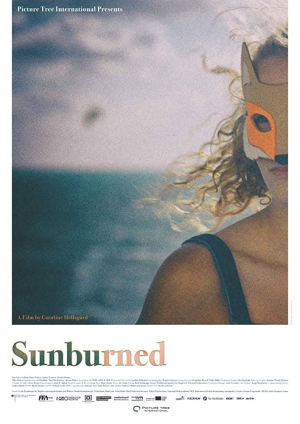 Sunburned Sunburned
