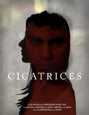 Cicatrices