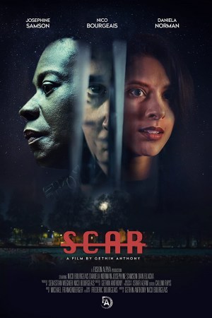 Scar