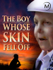 The Boy Whose Skin Fell Off