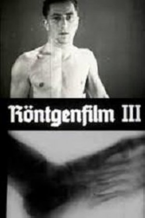 Röntgenstrahlen