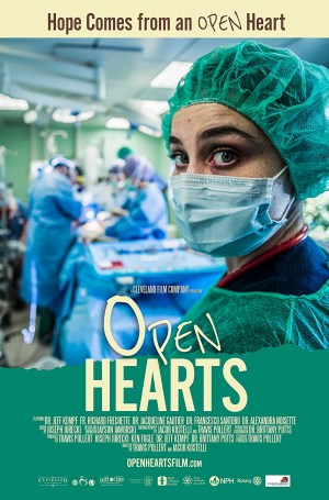 Open Hearts