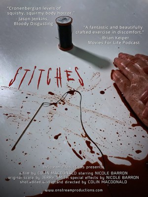 Stitches