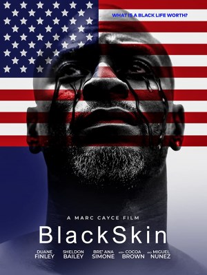 #BlackSkin
