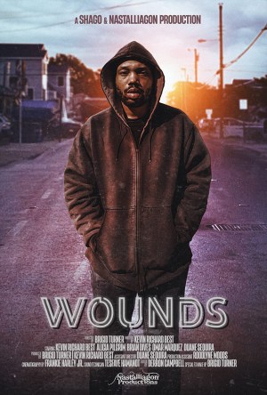 Wounds