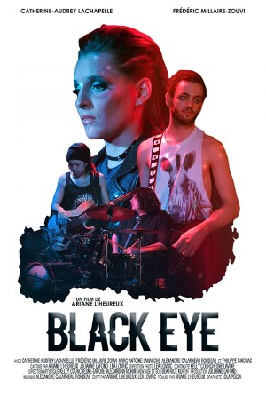 Black Eye