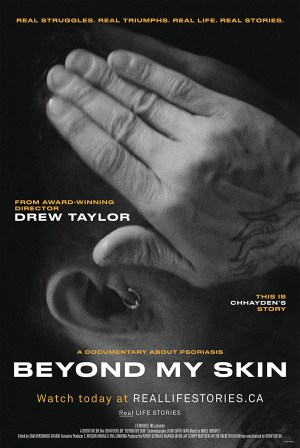 Beyond My Skin